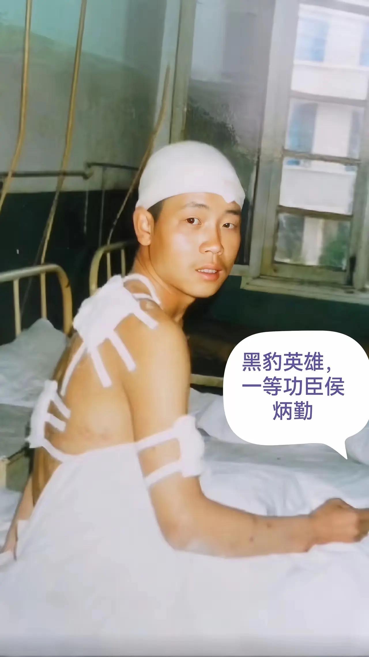 1987年，老山黑豹英雄侯炳勤身负重伤在医院治疗时的一幕，照片中他的头部，背部自