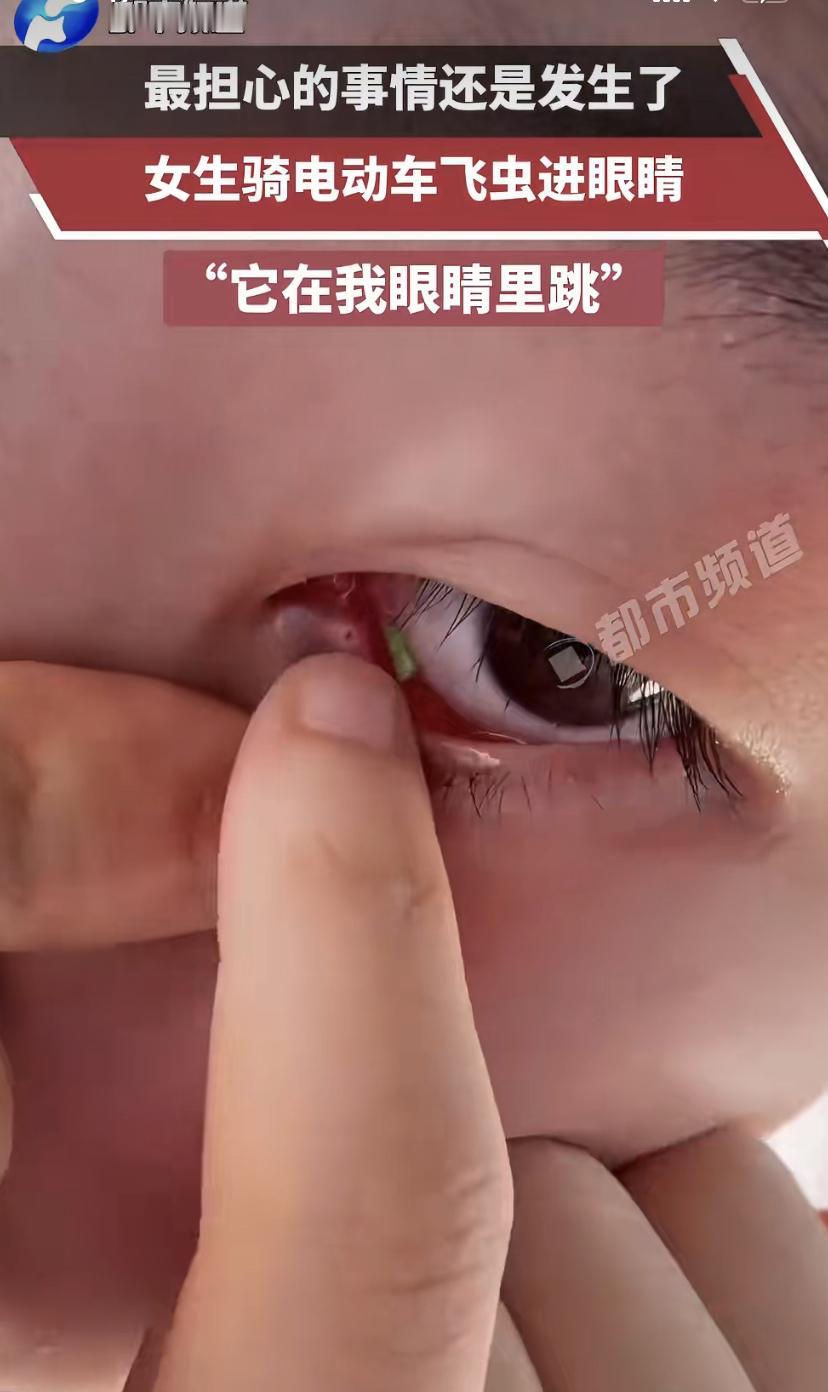 飞虫直撞眼球，女子这波操作险酿大祸

甘肃一位女士骑车骑得好好的，突然一只小飞虫