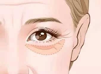 #健康真探社#【这些最易让女人显老的特征，多一个老10岁！】很多人说，爱笑的女孩