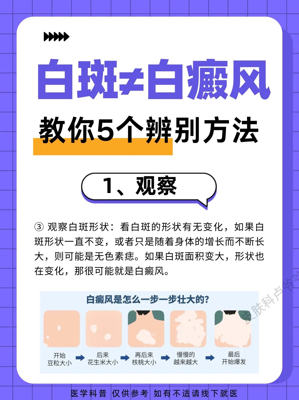 5个白斑辨别方法送给你