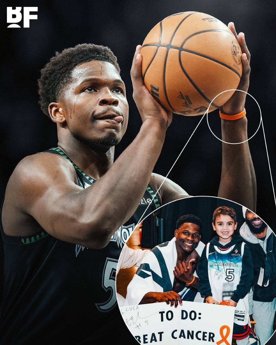 安东尼·爱德华兹至今仍戴着一年前从6岁的狼队球迷卢卡那里得到的腕带，卢卡当时被诊