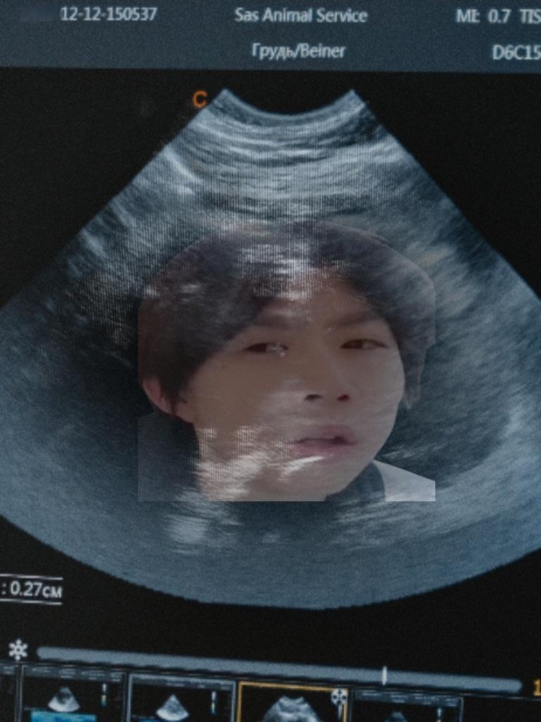 怀胎192个月了 ​​​