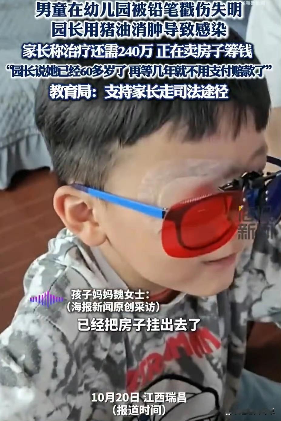 5岁娃在幼儿园被铅笔戳瞎左眼！园长不送医反倒用猪油抹伤口“消肿”，结果细菌长满眼