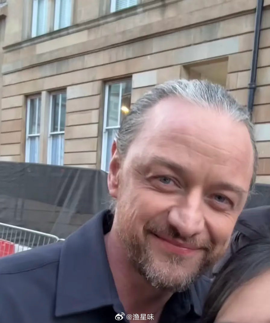 怎么老成这样了？欧美人真的不抗老 