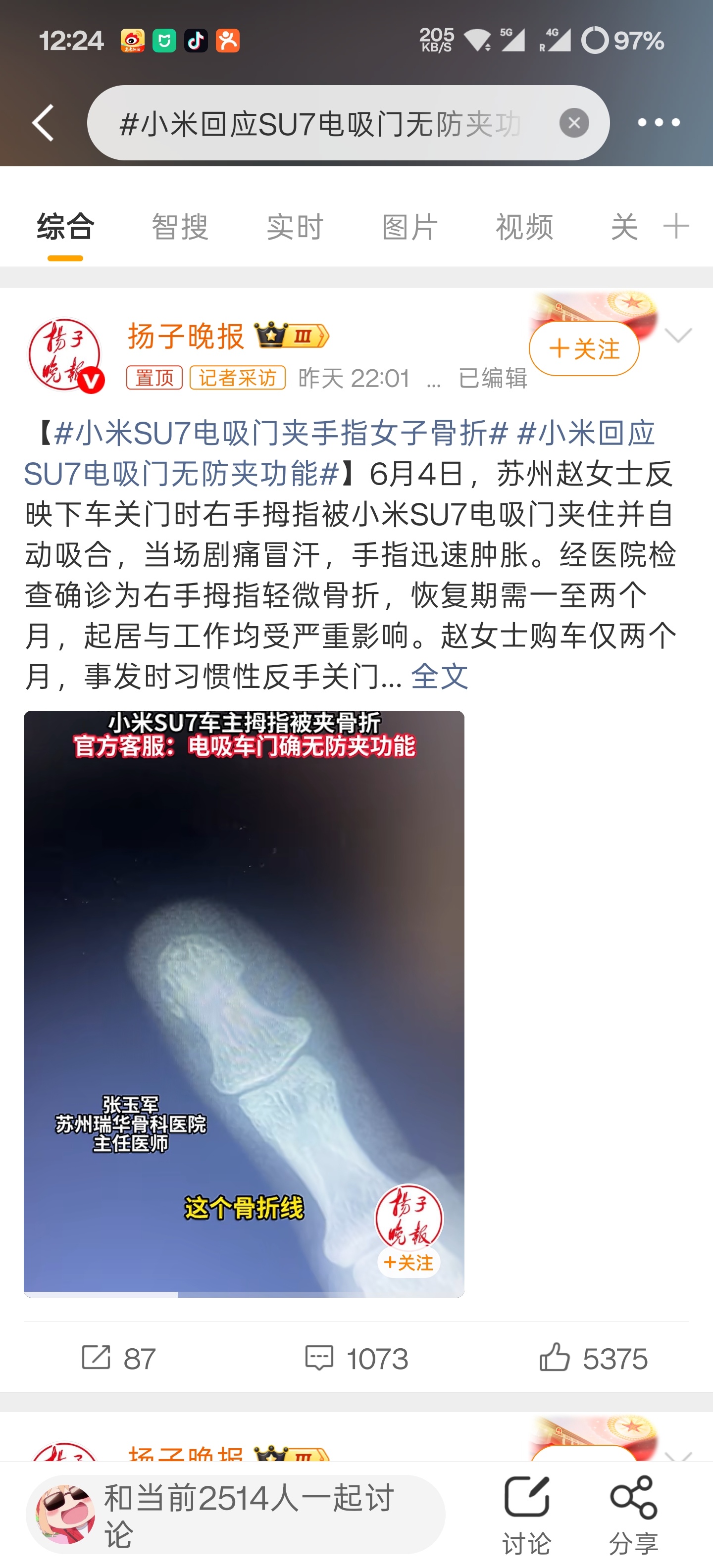 我的手去年9月就是被电吸门夹骨折了，然后拔了指甲才好现在还没恢复到最初的状态，想