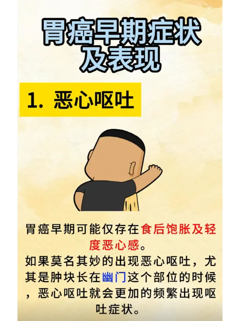 胃癌早期症状及表现有哪些？