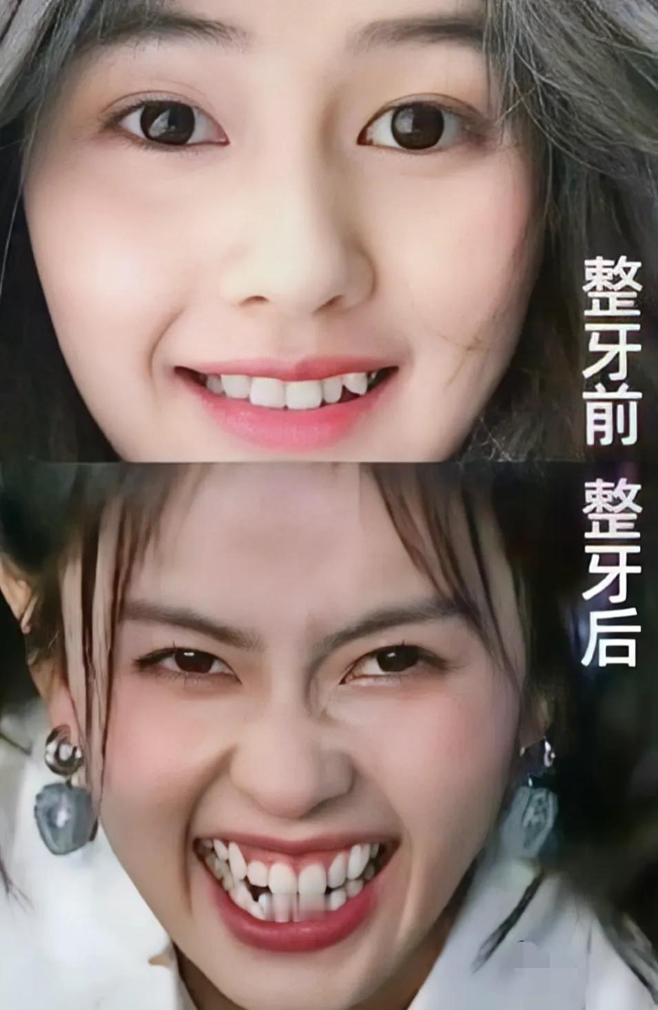 他这一笑，感觉牙白整了 