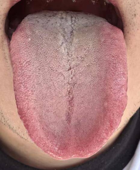 状态不如人意别发愁，老中医分享实用调养思路






有不少年轻的朋友因为伤精