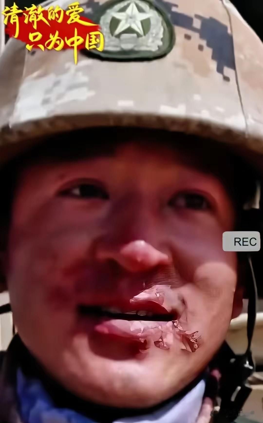 泪目了！记者采访边防战士时，战士却始终不肯摘下面巾，问及原因时，战士只是腼腆笑笑