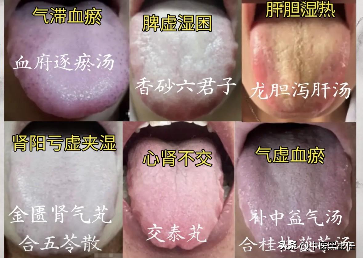 男人“不行”别只怪肾虚！6大元凶掏空身体，倒数第二个最致命，伸舌就能辨！

1.