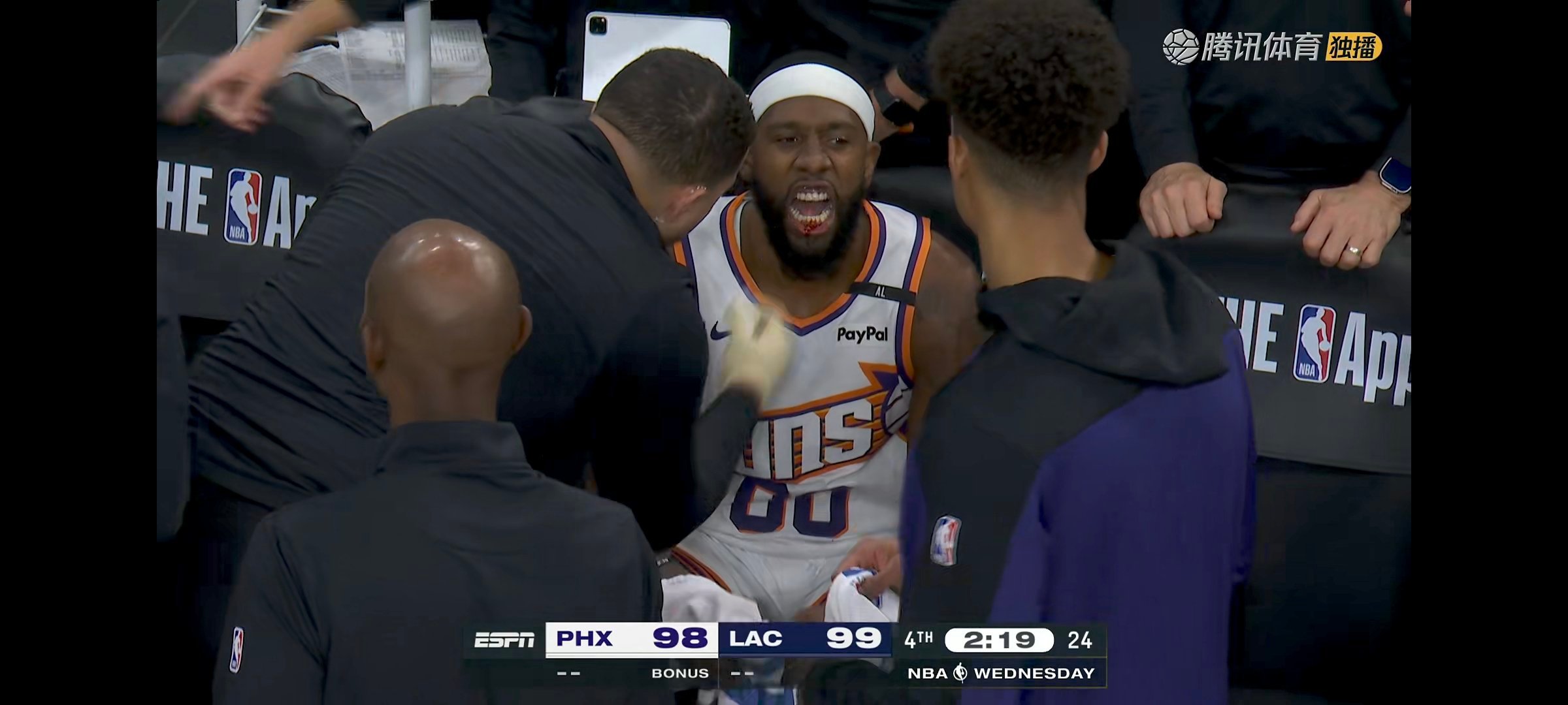 奥尼尔被打出血了。。。他的防守真的是豁出去了[傻眼]#太阳vs快船##nba新赛