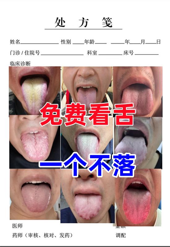 清明不休息，继续帮大家看舌[灵光一闪][灵光一闪]，我看舌从来都是公益的，一个不