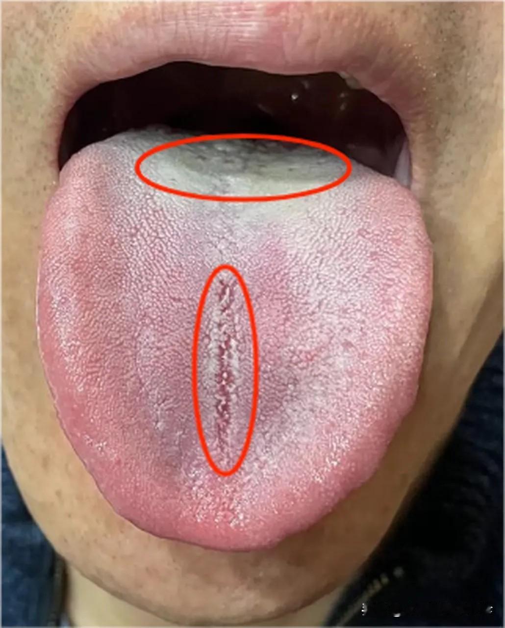 大哥，别再瞎折腾了，再不停手，一辈子就废了！

患者主诉：情绪不稳定，一点小事就