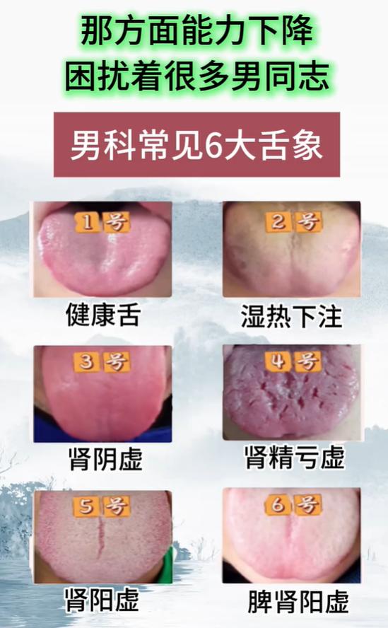 湿热、阴虚、阳虚各有舌象特点，看懂舌苔，从根源呵护海绵体健康