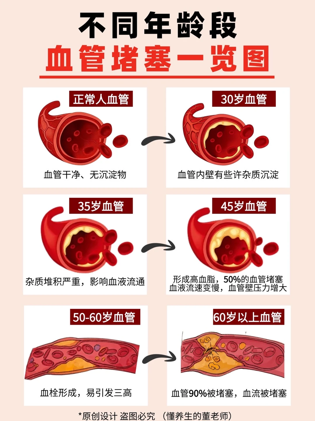 30+必看血管养护指南！你的血管堵了没