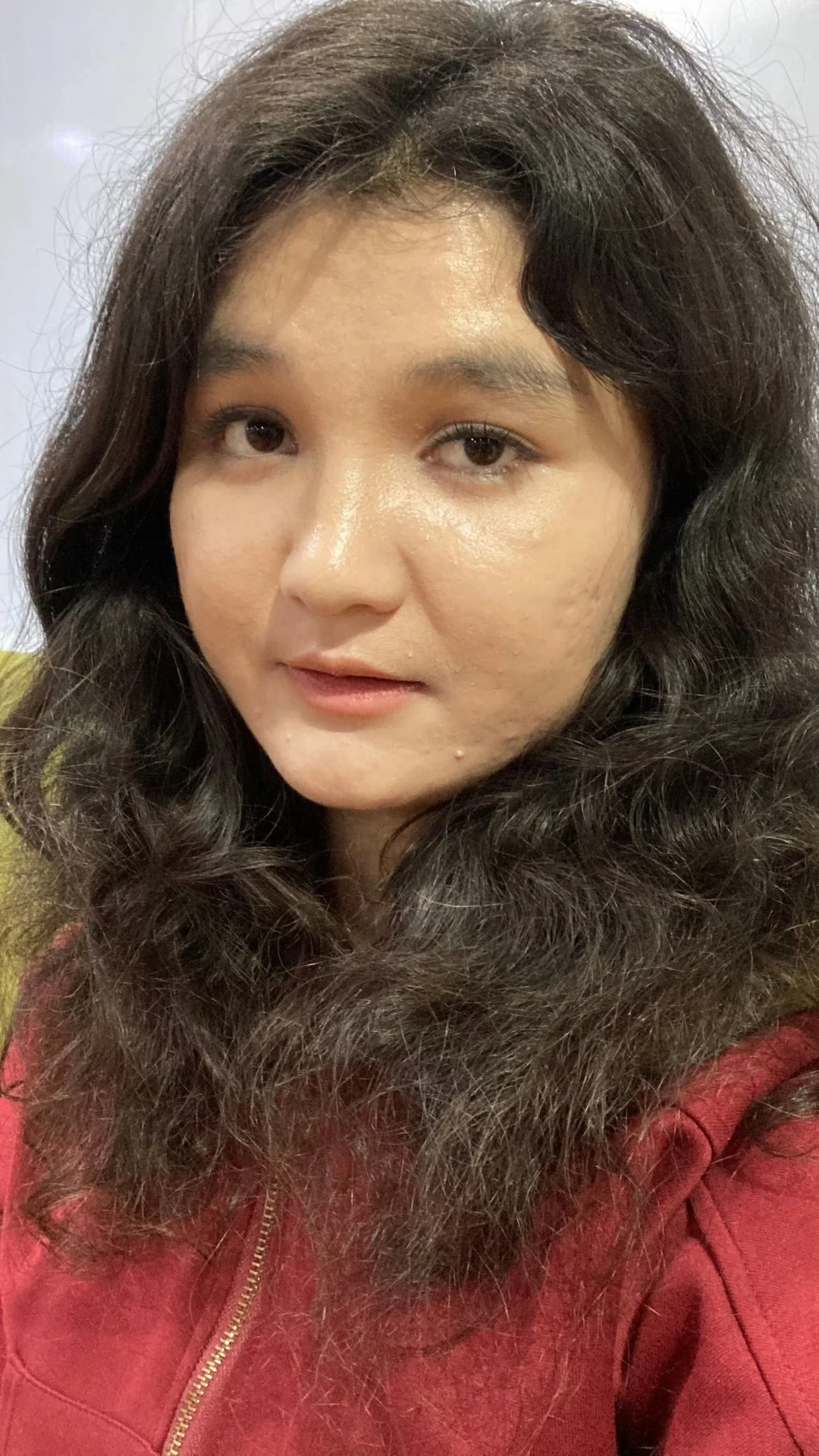 豆坑肉眼可见平整了