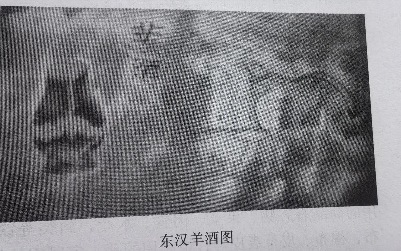 两汉，你就怎么这么爱喝酒，说说你都想不到的那些酒文化

酒须用粮食酿造，所以汉初