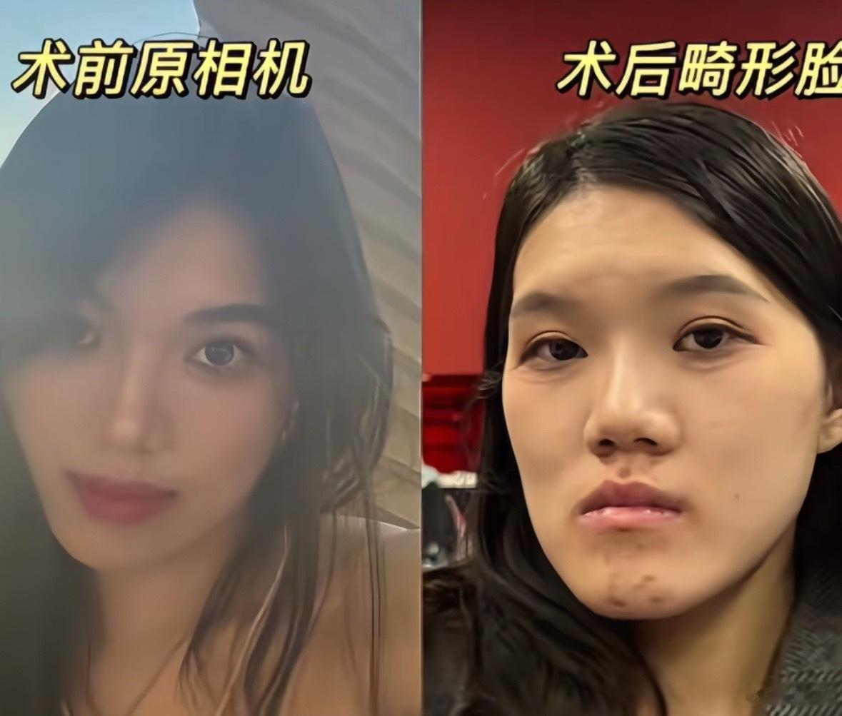 卫健委介入24岁女孩正颌手术被做反还能发生这样离奇的事，这是当年上网课的那波人走