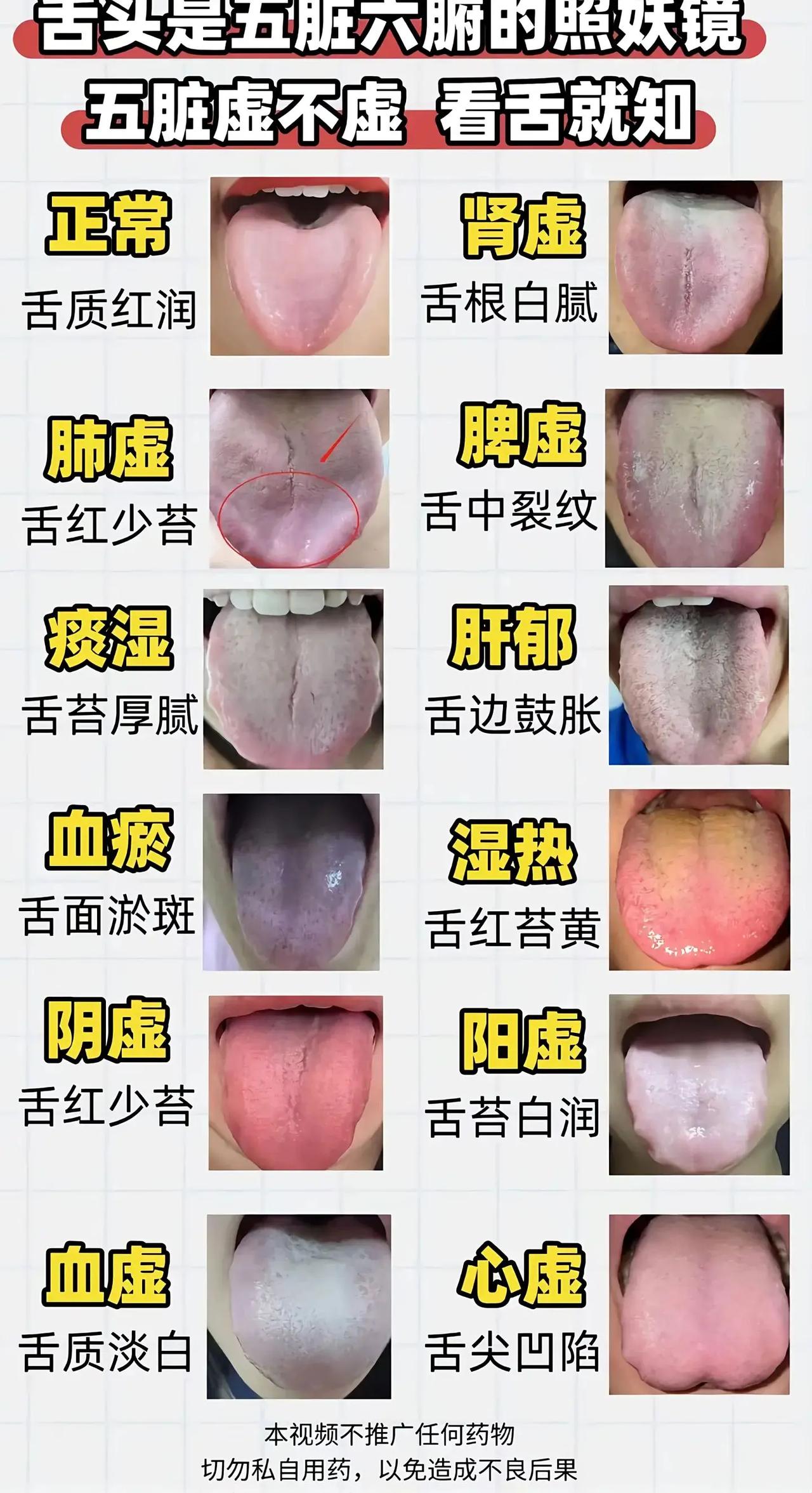 舌头如镜，映照五脏六腑。中医有云："望闻问切，舌诊为先。"观舌苔之变化，知身体之