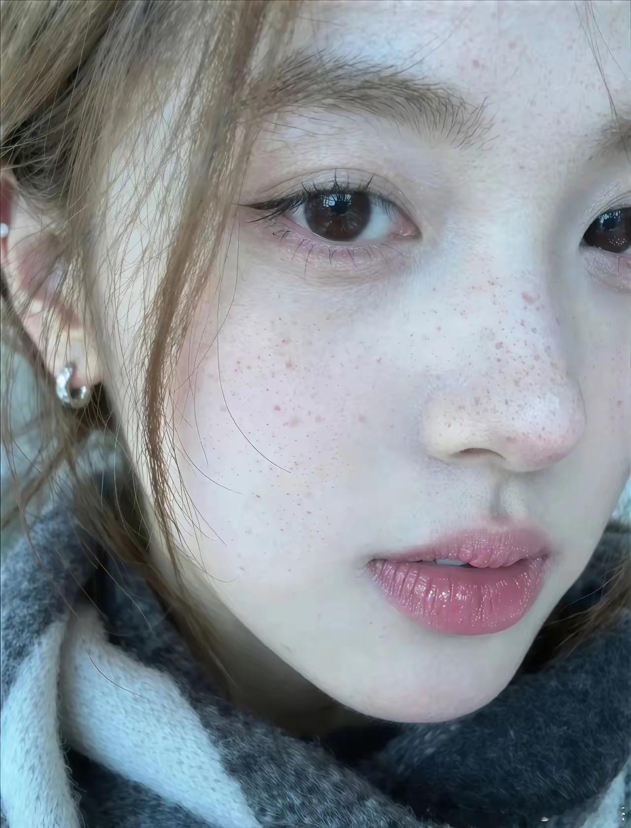 雀斑影响容颜吗？实话实说。 ​​​