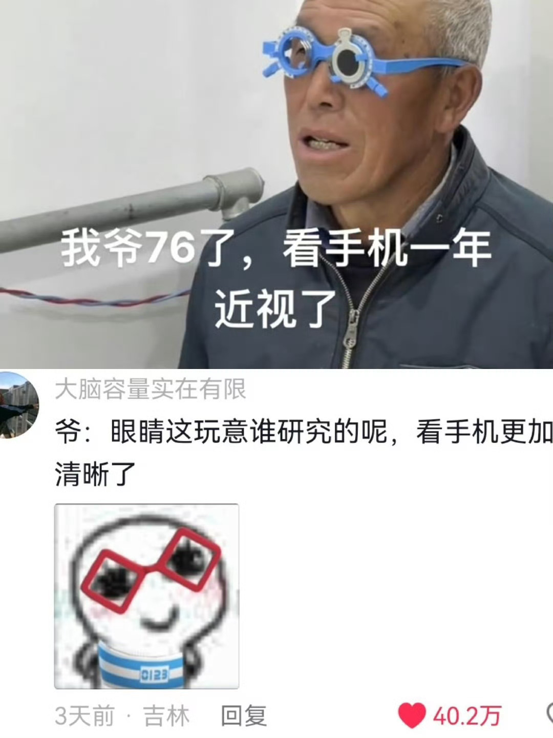 正是远视的年纪怎么近视了 