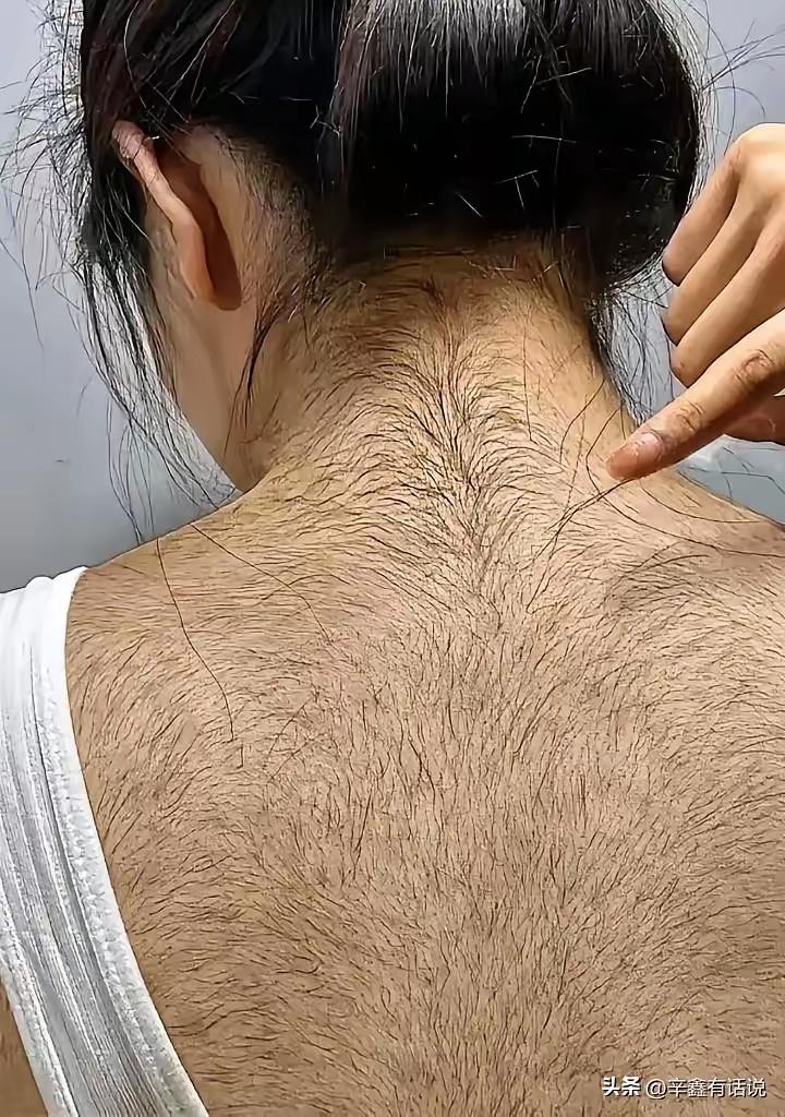 鬣狗和猎豹说，你和我结盟双赢，你负责打工，我负责消化猎物，你要是和我一刀两断，后