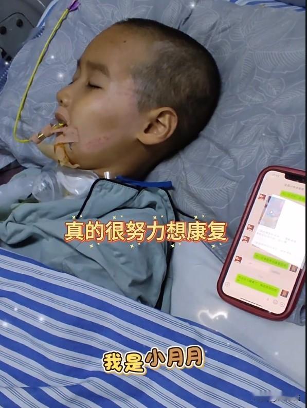 刘楚熙的妈妈24日晚更新了，刘楚熙能抬起头了，妈妈发出了人猿泰山似的叫声。这次是