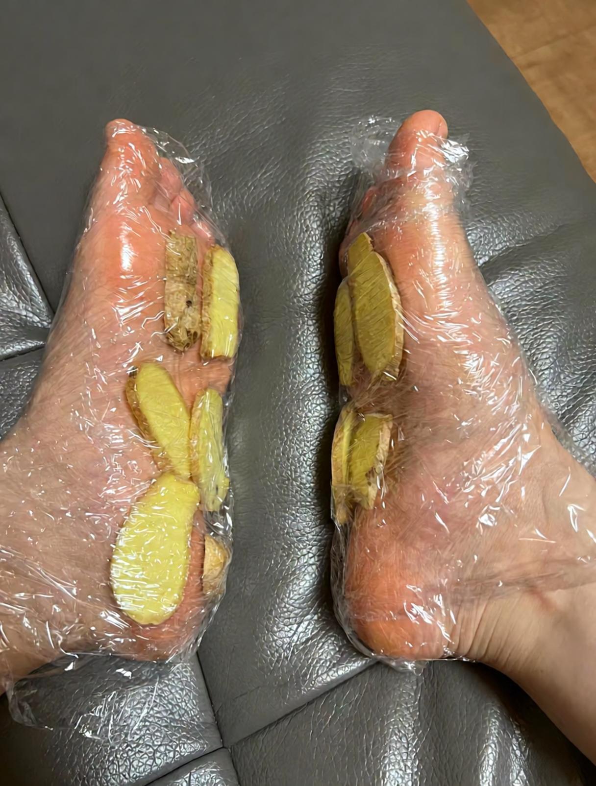 夏天吃姜.我用姜敷脚