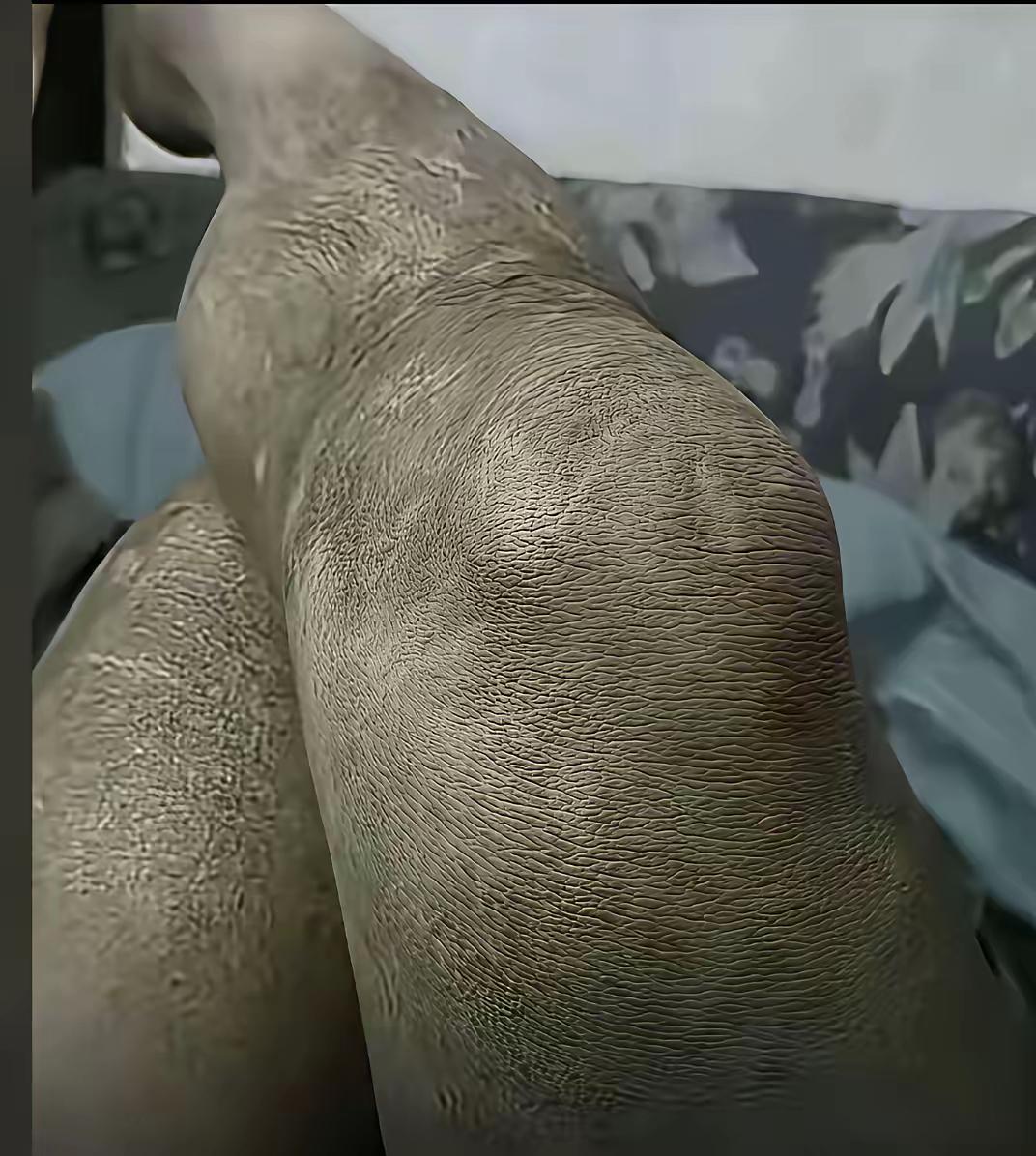 兄弟姐妹都好好看看，这个应该挂那个科？