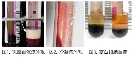 异常标本状态