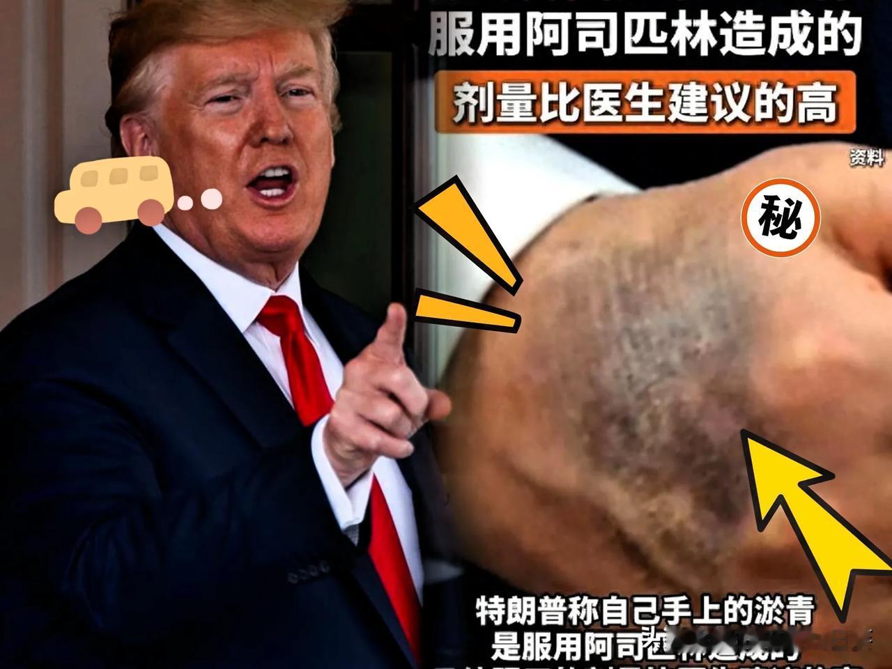 白宫这公关水平

我是真服了

懂王手上那块大淤青~

发言人非说是“握手太用力