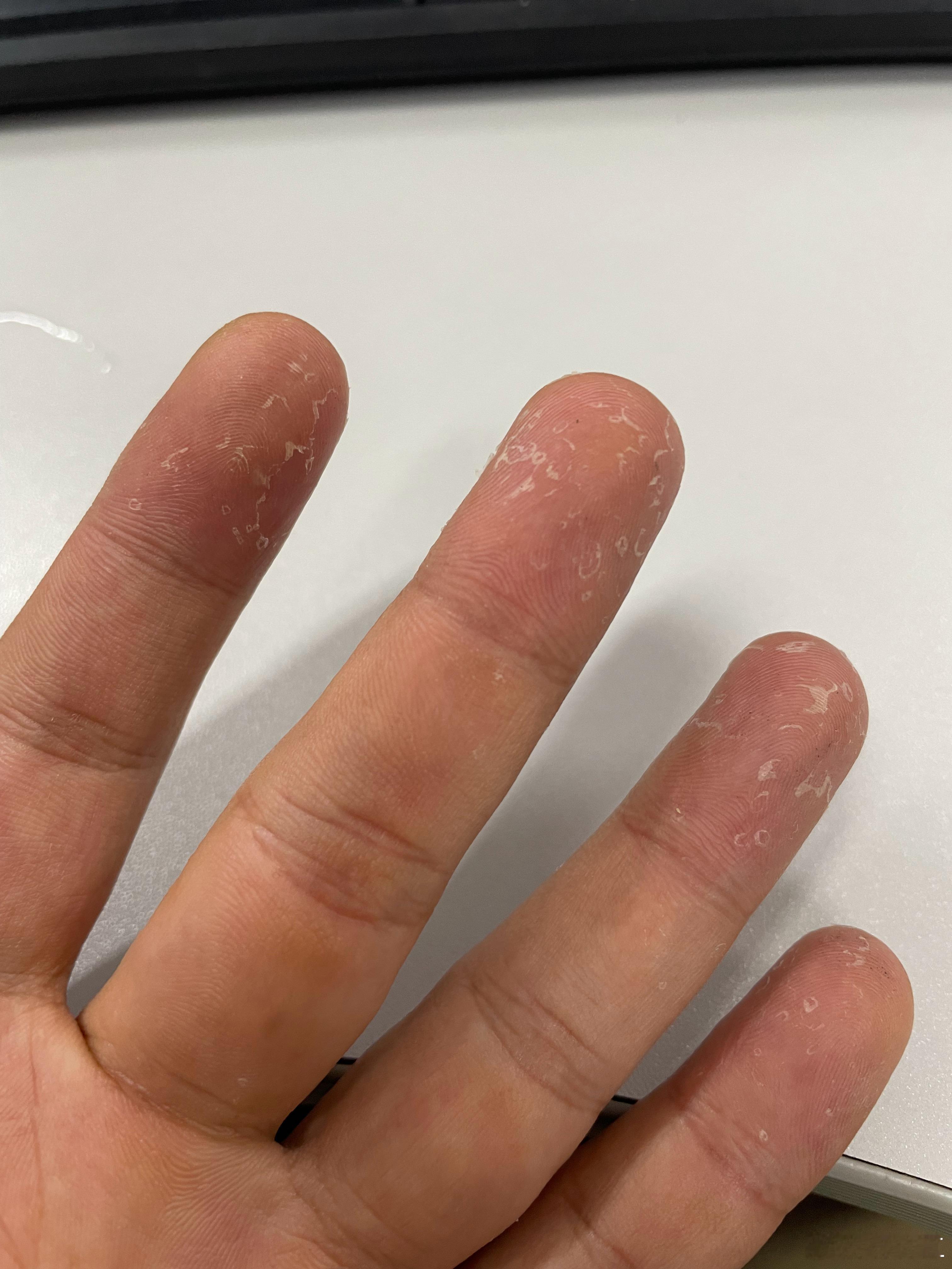 这一年一度的蜕皮季，蜕完了又是一条新汉子？ 