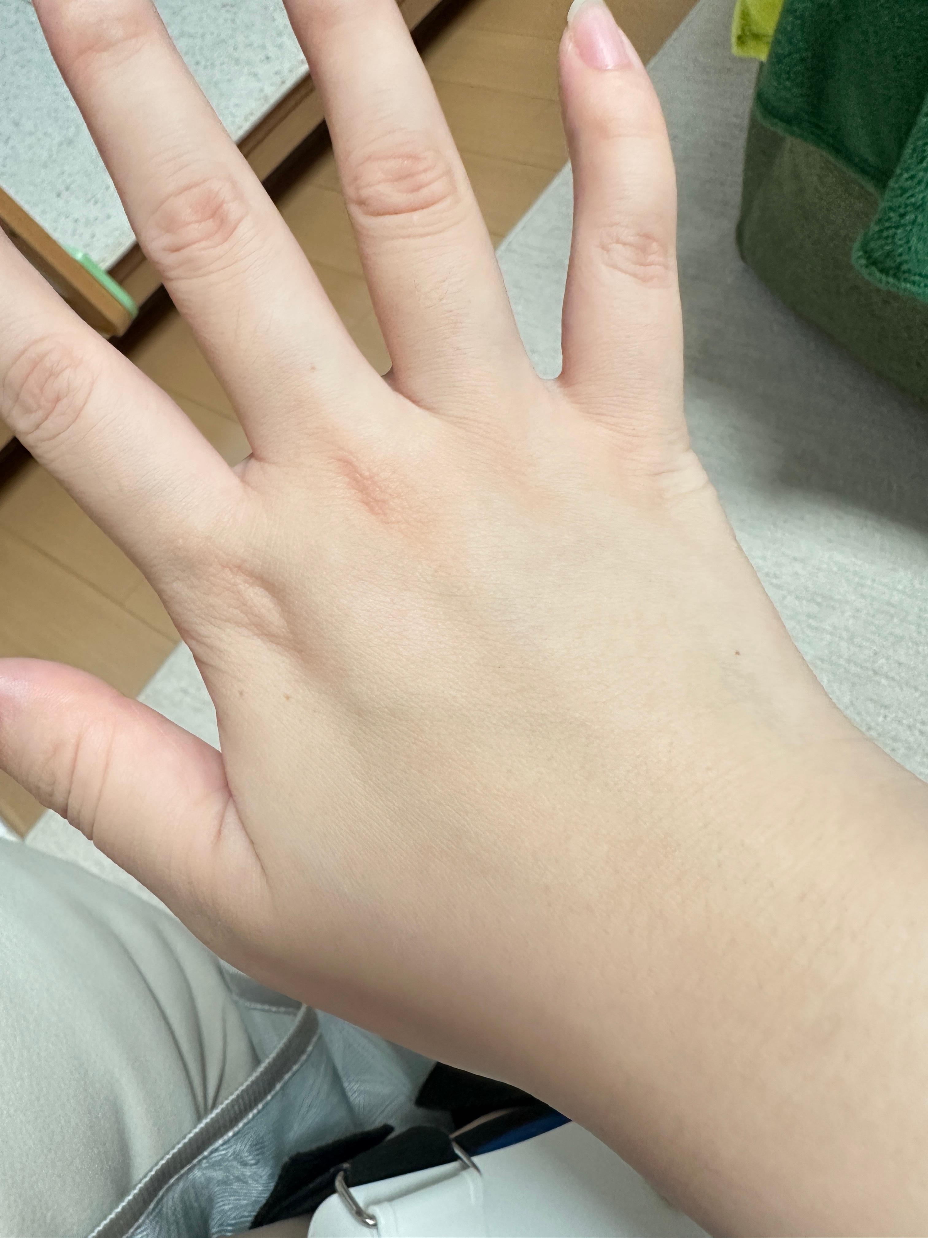 一个半月没出门晒太阳手好白啊 哈哈哈 