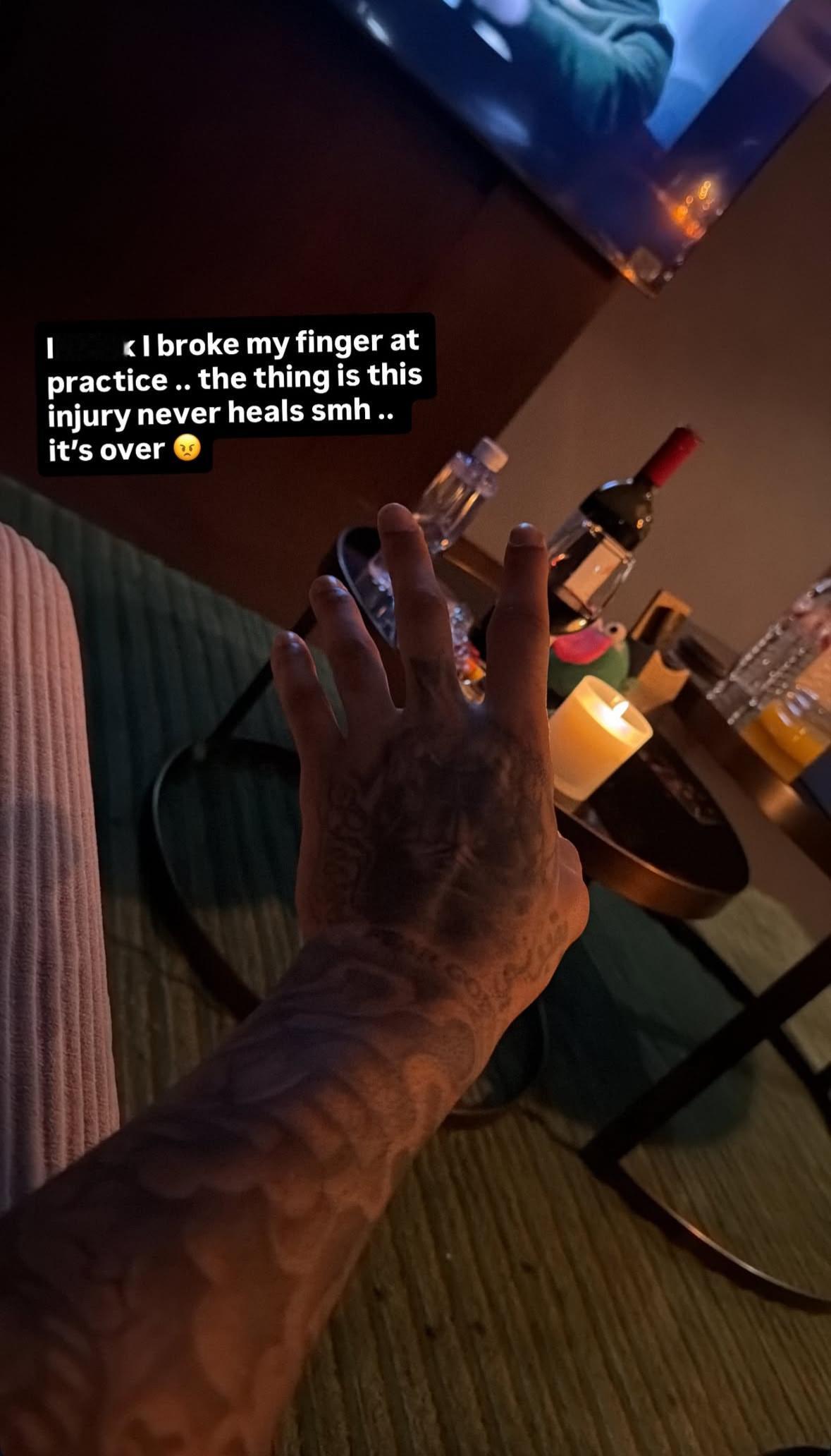 莫兰德更新ins story 左手食指在训练时 “吃了萝卜干”肿了好大莫兰德说：