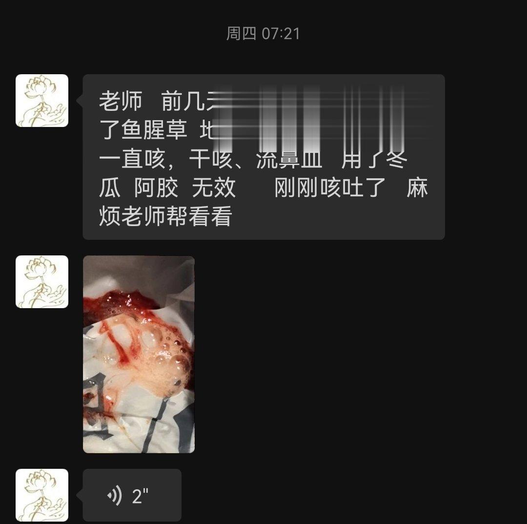 热毒陷肺，是也。瓜蒌40芦根100 一天一剂，吃了三天了，越来越好。 ​​​