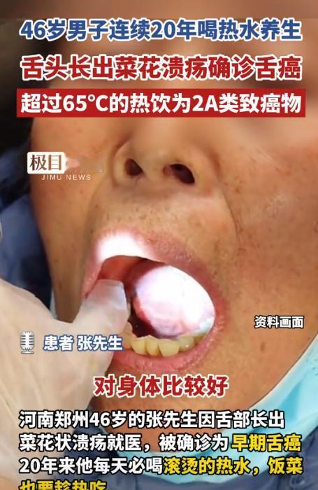 “悲剧还是发生了！”河南郑州，一46岁男子发现嘴里有菜花状的溃疡后，便紧急去医院