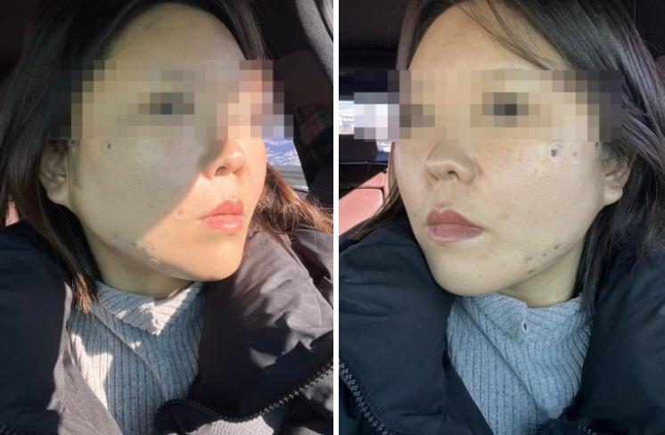 今天去的一家韩国做提升很火的医院，最大的感受就是：专业感真的和普通流水线医院不一