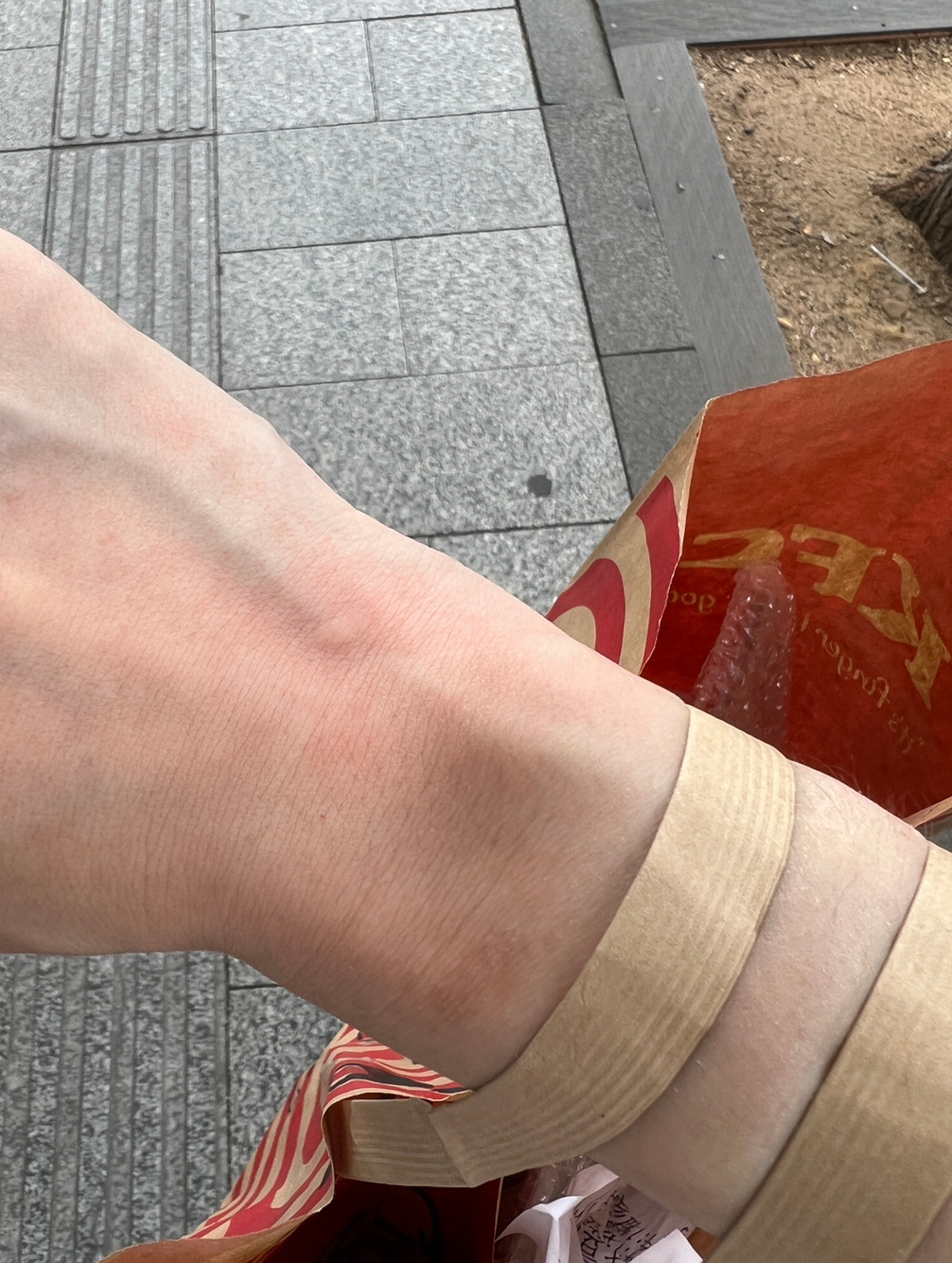 中午出去取个餐也能被蚊子咬了，这大白天的，是不是我的血管太明显了