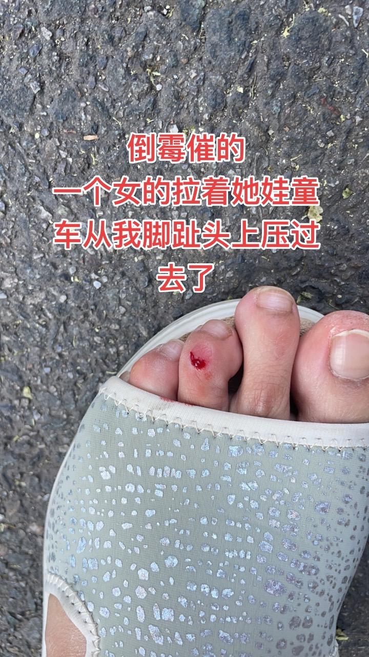 倒霉催的
一个女的拉着她娃童车从我脚趾头上压过去了