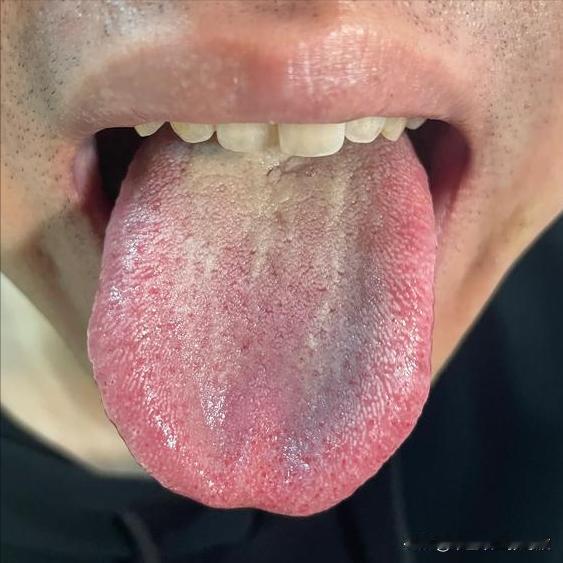 火气这么大，你们一天天的都干嘛了！刚说完就是不听[发怒][发怒]
主诉：吃什么都