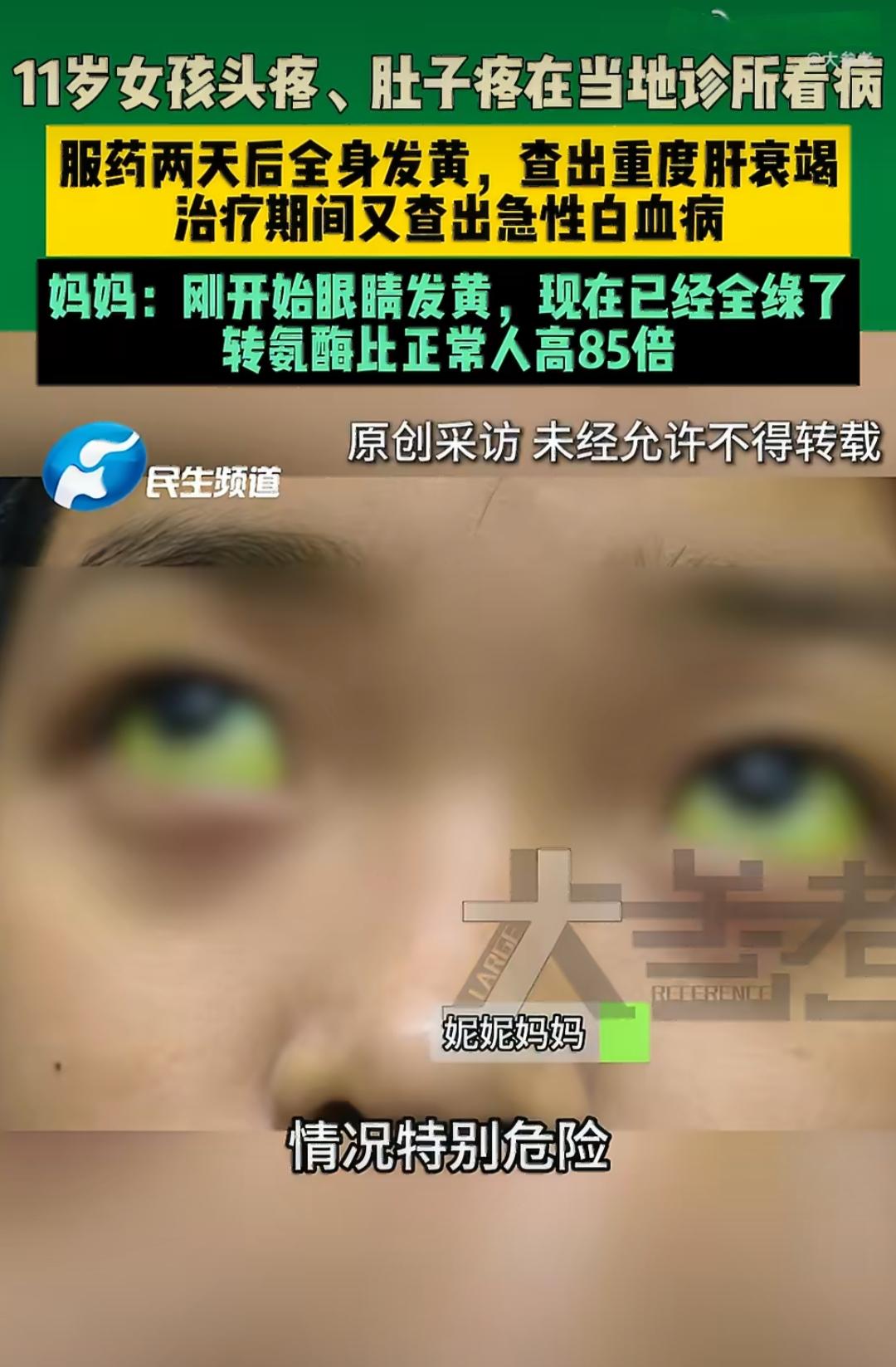 11岁的妮妮因为头疼、肚子疼，在当地诊所看了病，可吃了两天药后，整个人突然变得黄