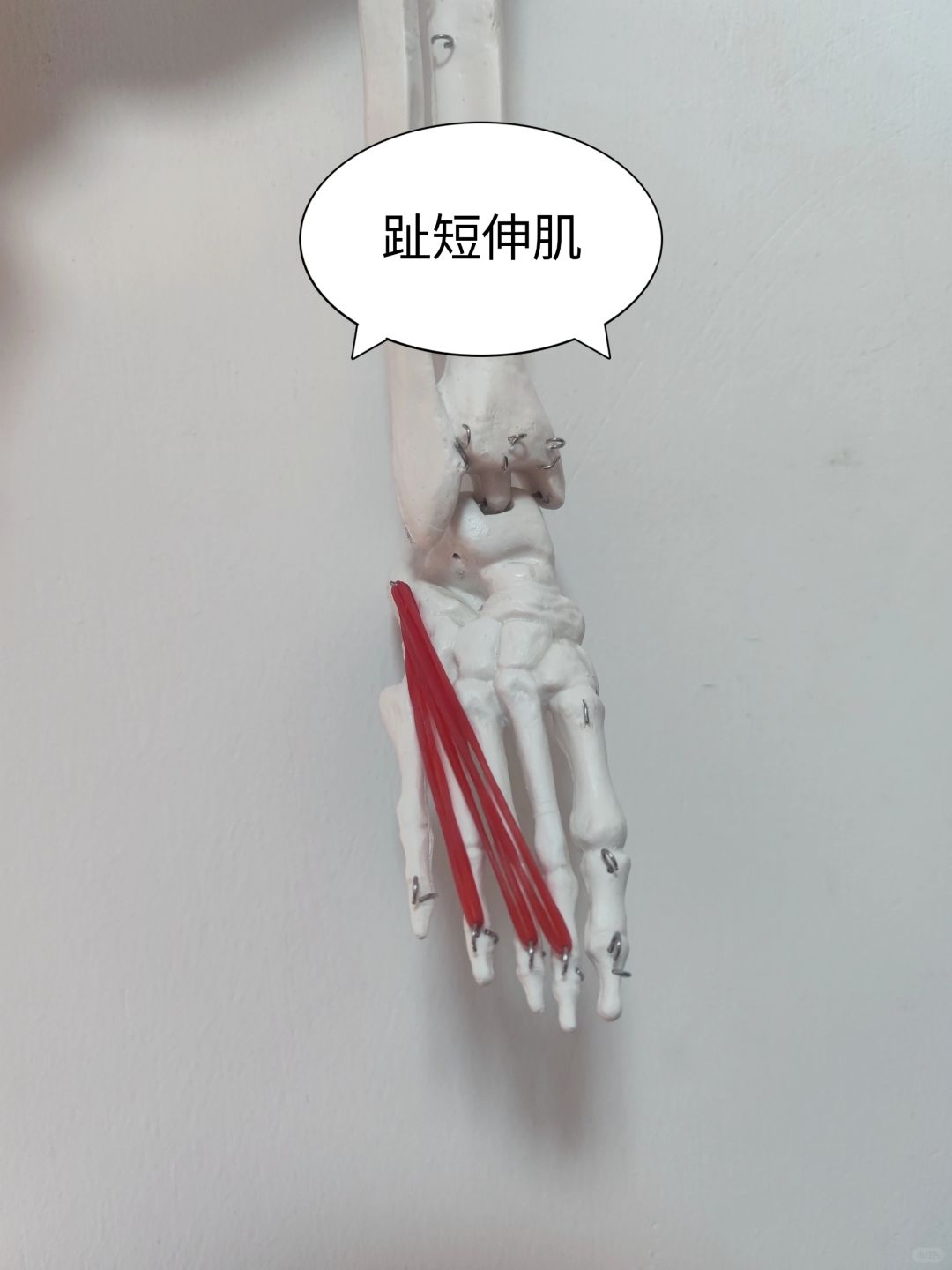 趾短伸肌