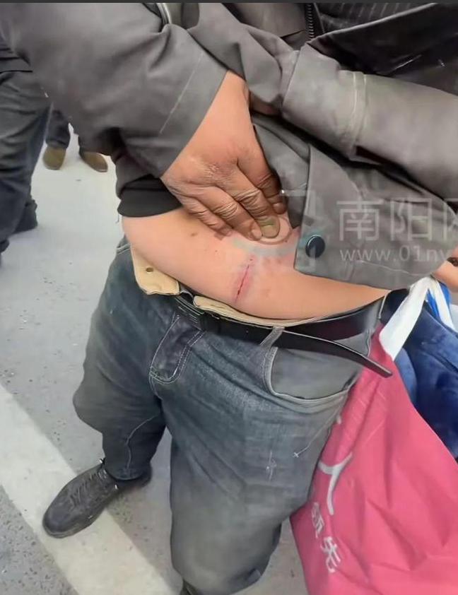“谁说好人没有好报！”河南洛阳，卖粉条的大叔勇救13岁落水女孩，肚子却被河里的钉