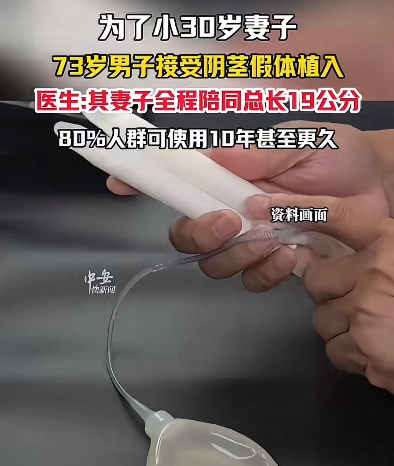 “还是大爷玩的花！”谁能想到，一位73岁的大爷，为了能让比自己小30多岁的妻子“