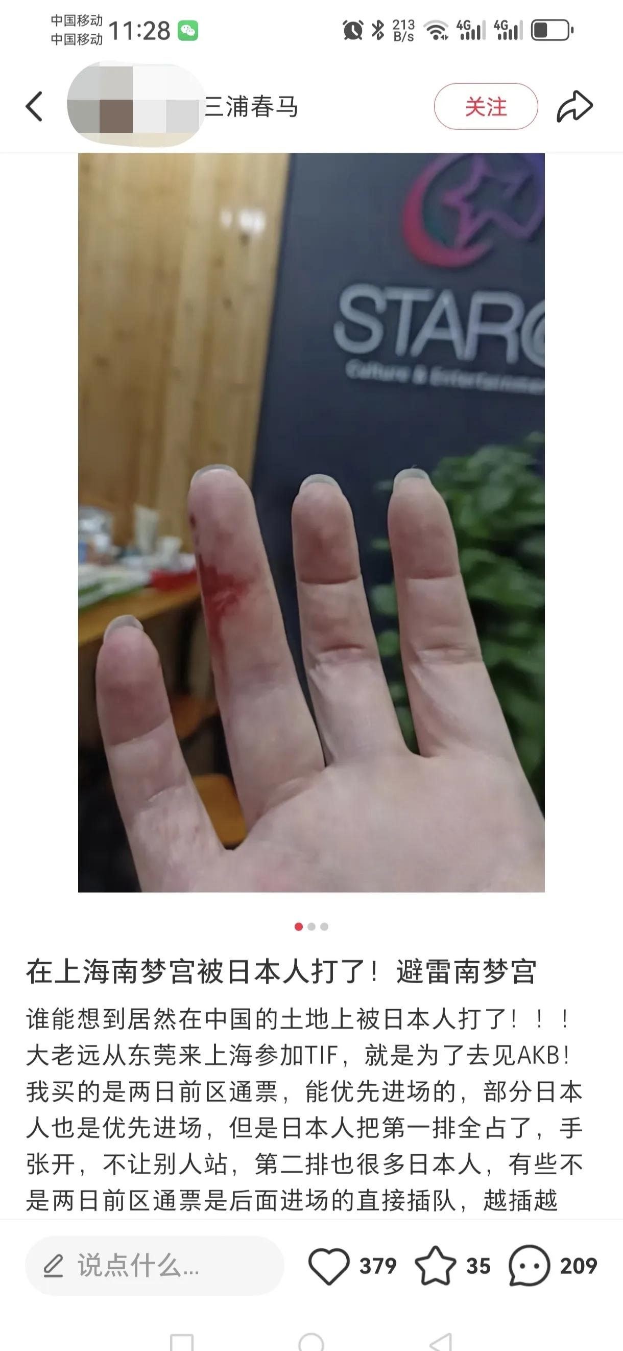 男子跑去上海看演出，不曾想被日本人群殴，经过上海警方调解，只赔偿了2000元。