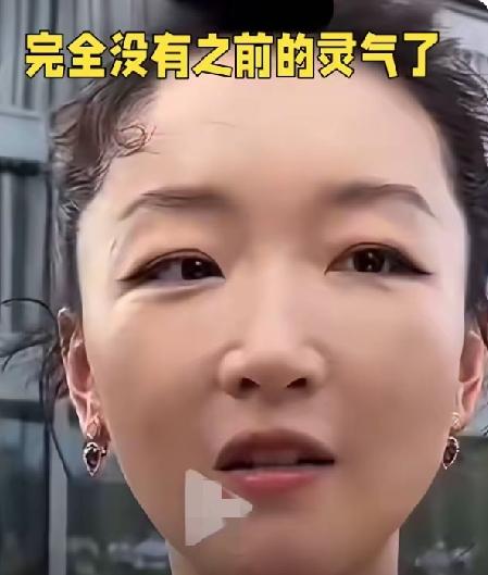 周冬雨的脸也肿了，看着非常的不自然。完全没有了当初的清纯模样，还是原生态脸好看顺