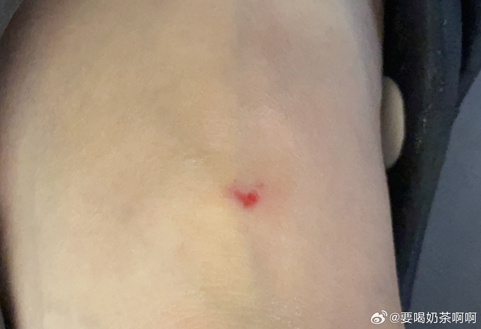 大家今天都辛苦啦，借我受伤的jio背给大家表个白吧爱你们，连伤口都是爱你们的形状