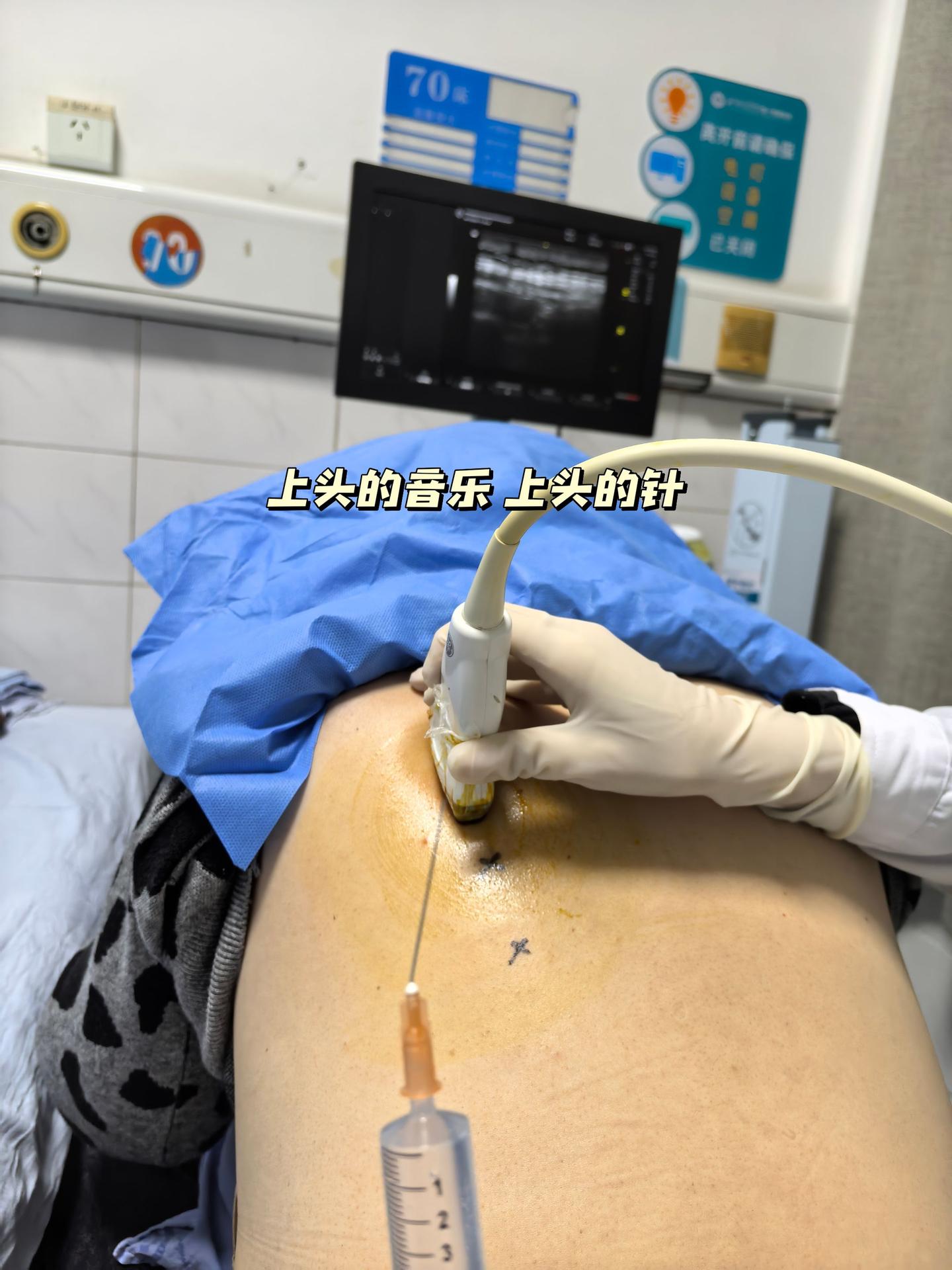 猜一下针头为啥是弯的