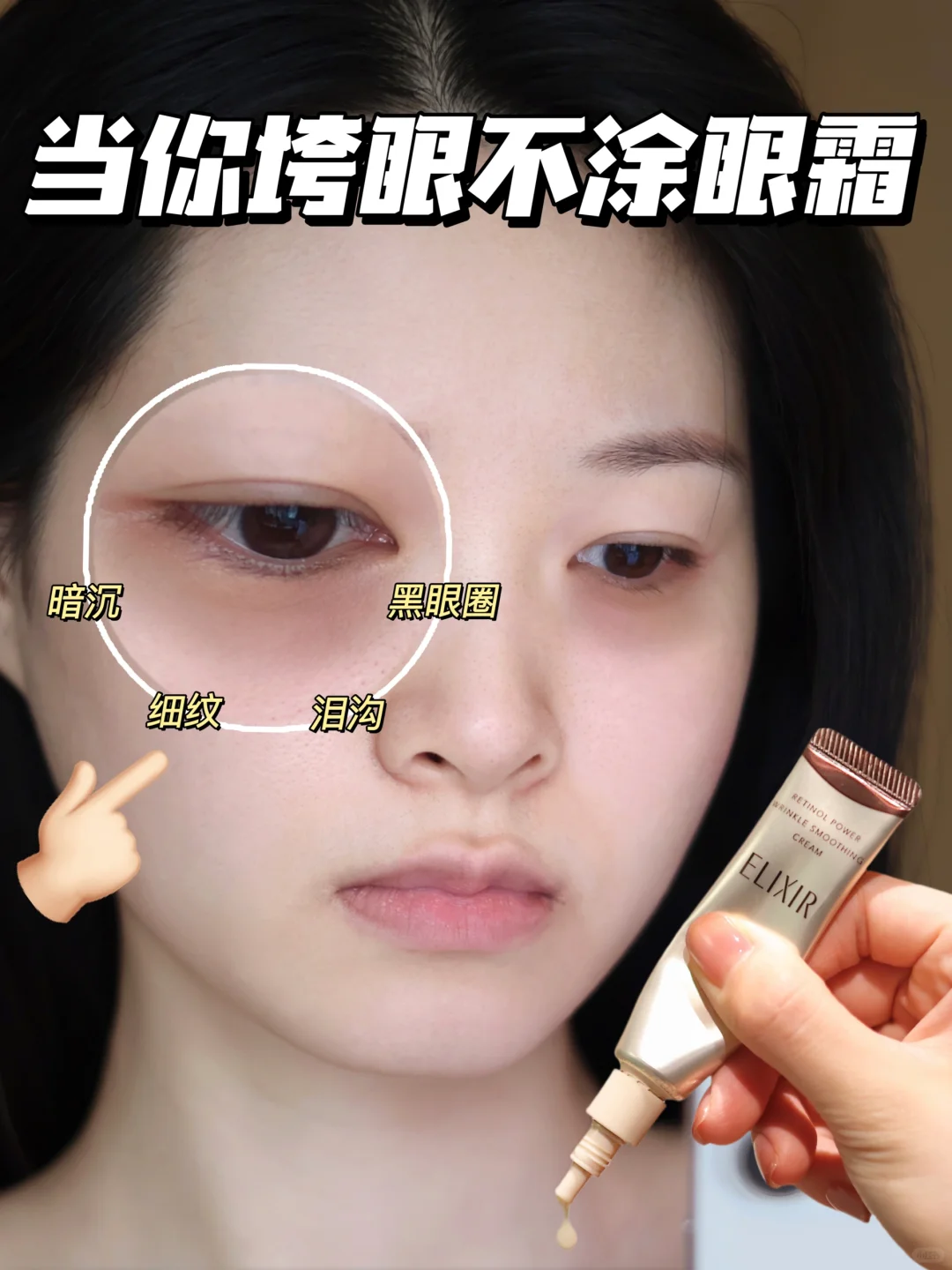坚持用眼霜的第n天｜眼纹：已老实，求放过