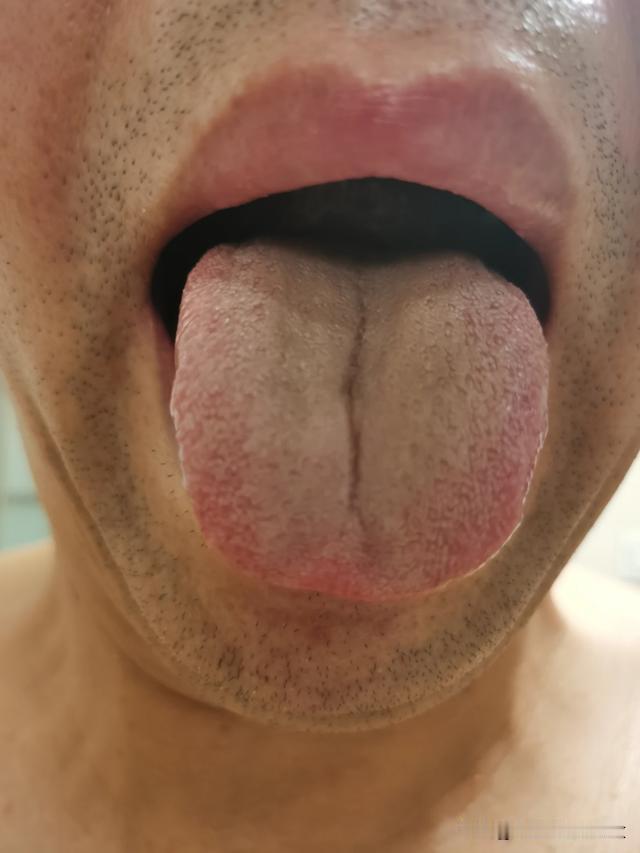 大哥，你这生活得糟心成啥样，才能把身体糟蹋成这样[what][what][wha